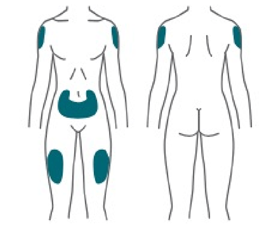 Injection sites labeled on the body