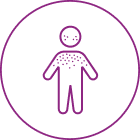 Allergic reaction icon