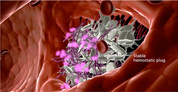 Illustration of NovoSeven® RT resolving the bleed by allowing the formation of a stable hemostatic plug