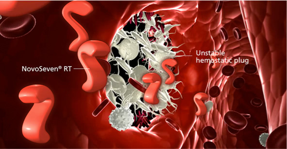 Illustration of NovoSeven® RT entering the bloodstream and targeting the site of injury